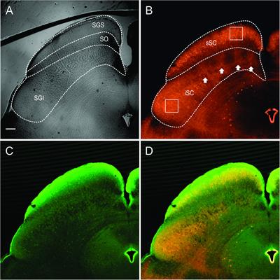 Parvalbumin and GABA Microcircuits in the Mouse Superior Colliculus